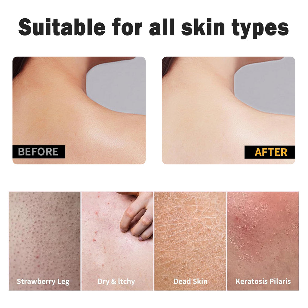 4 Counts Soft Rubber Shower Scrubber for Efficient Cleansing Body, Painless Remover Dead Skin Rubber Shower Scrubber, Skin Scrubber Exfoliator, Black